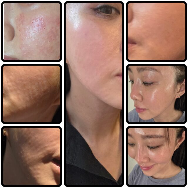 KFM 膠原蛋白精華 30支 - Image 2